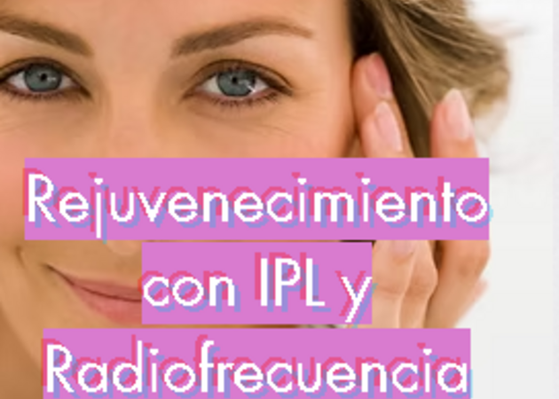 Galería de imágenes Lola Cé 1